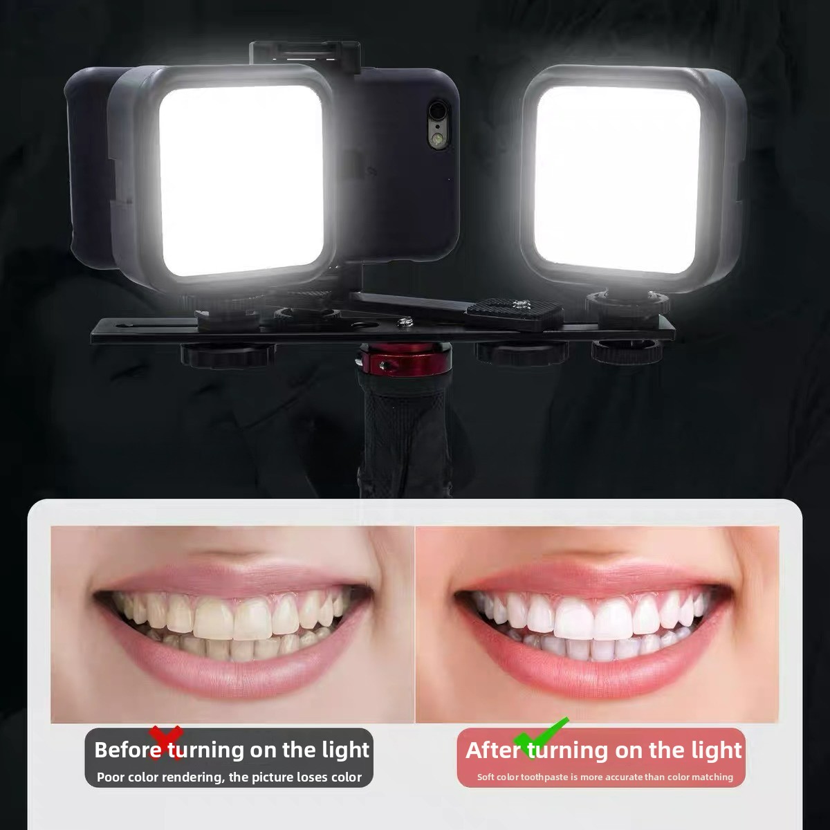 Luz de Fotografia Odontológica - Photography Basics avaliação e preço